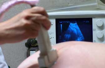 Carlos Amado Sarti - Foto 1